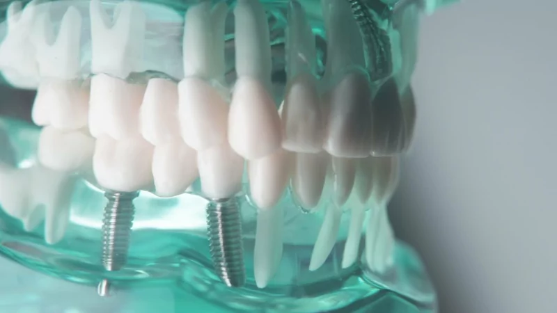 Юрист Бендер Андрей Владимирович объясняет: Действия при ненадлежащем качестве лечения в стоматологической клинике: