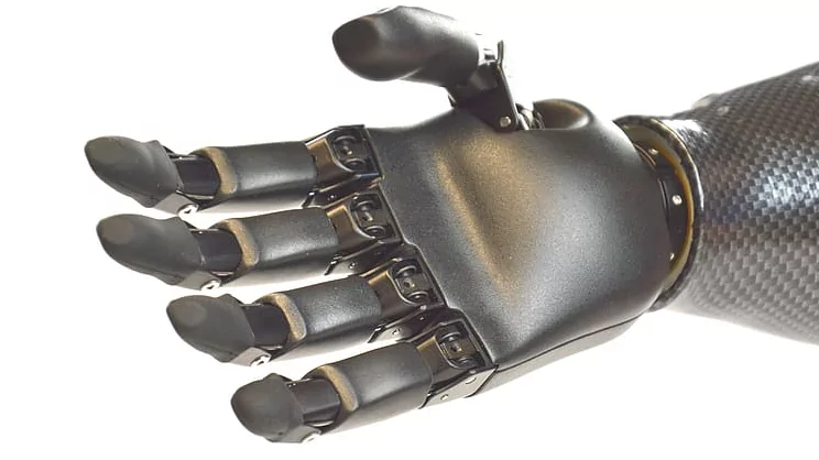 Юрист Жуйкова Юлия Валерьевна объясняет: Как бесплатно получить высокотехнологичные протезы